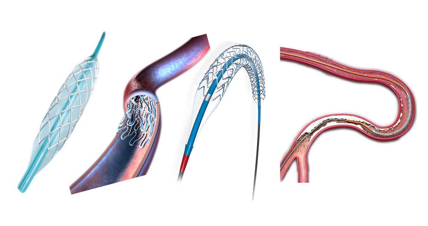Cardio Vascular Interventional Devices LifeServ'